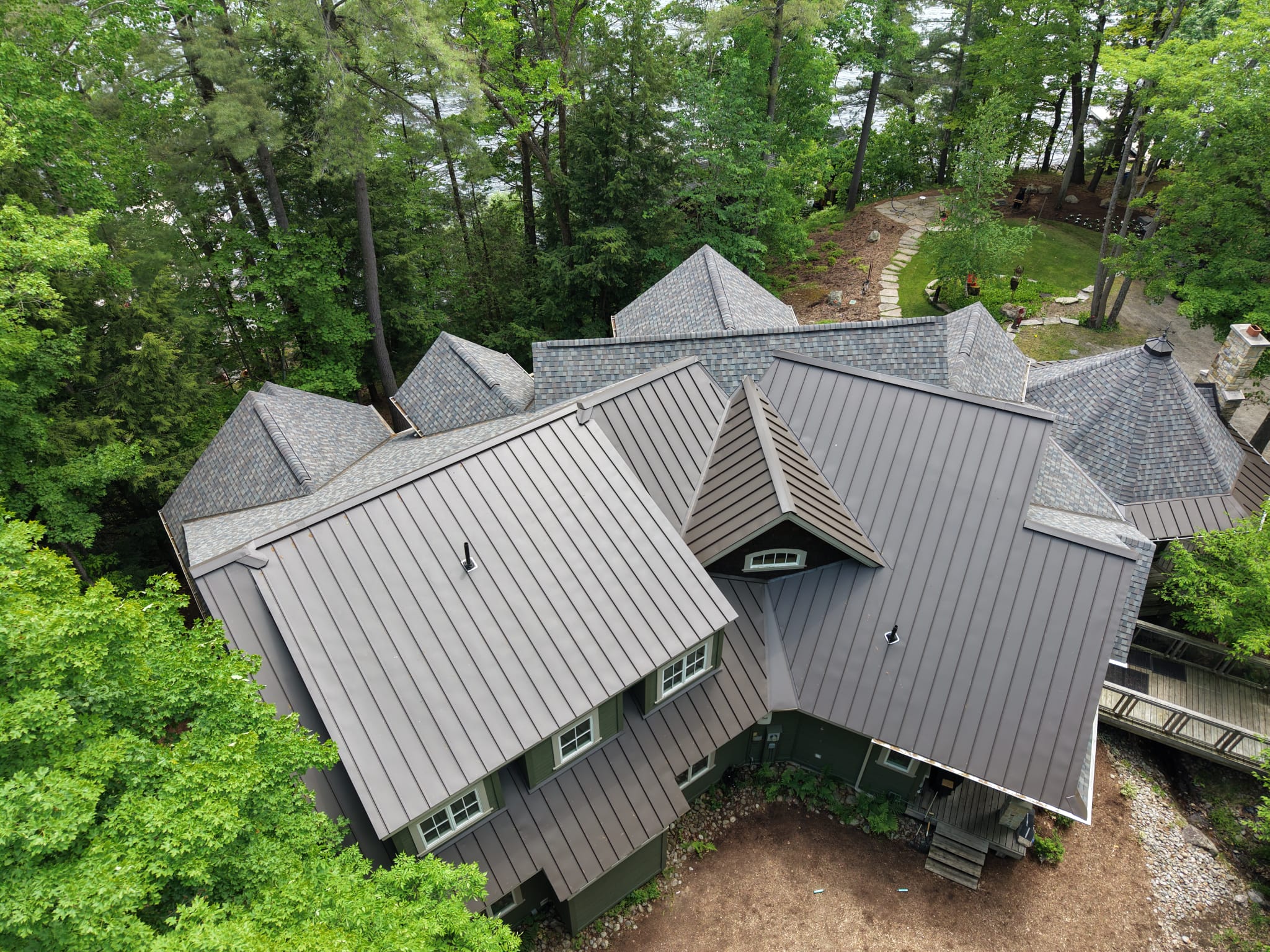 Standing Seam + Shingles — Bracebridge Muskoka Cottage in Bracebridge, Muskoka, ON